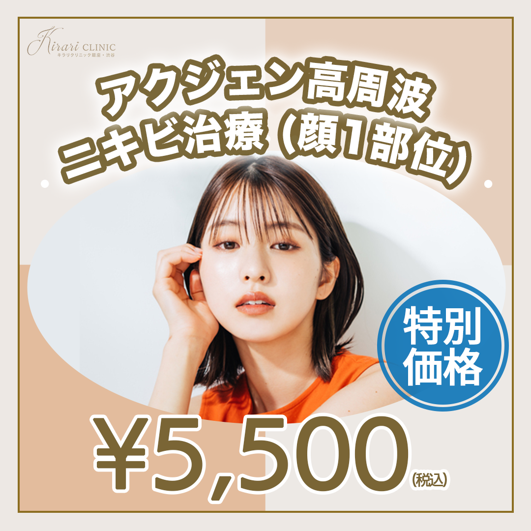 初回】アクジェン高周波ニキビ治療（顔1部位）1回 | キラリ
