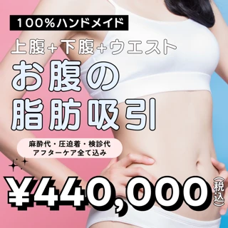【モニター】お腹の脂肪吸引(上下腹部+ウエスト)