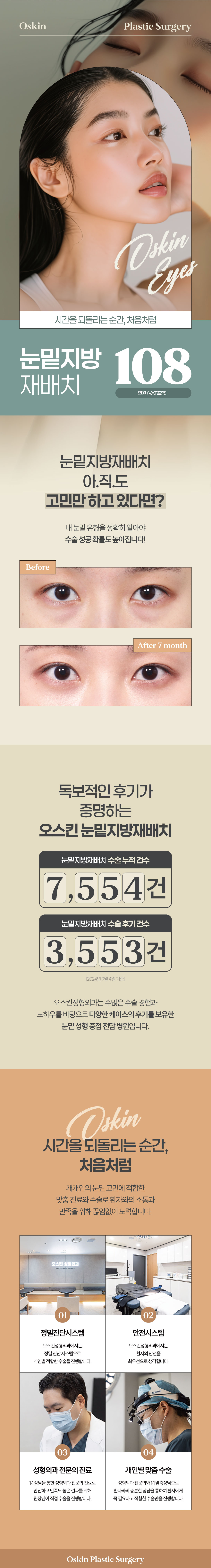 독보적인 후기가 증명하는 오스킨성형외과의 눈밑지방재배치
눈밑 유형을 정확히 판단하여 개개인 눈에 따른 수술플랜으로 눈밑을 환하게 해주는 오스킨 눈밑지방재배치