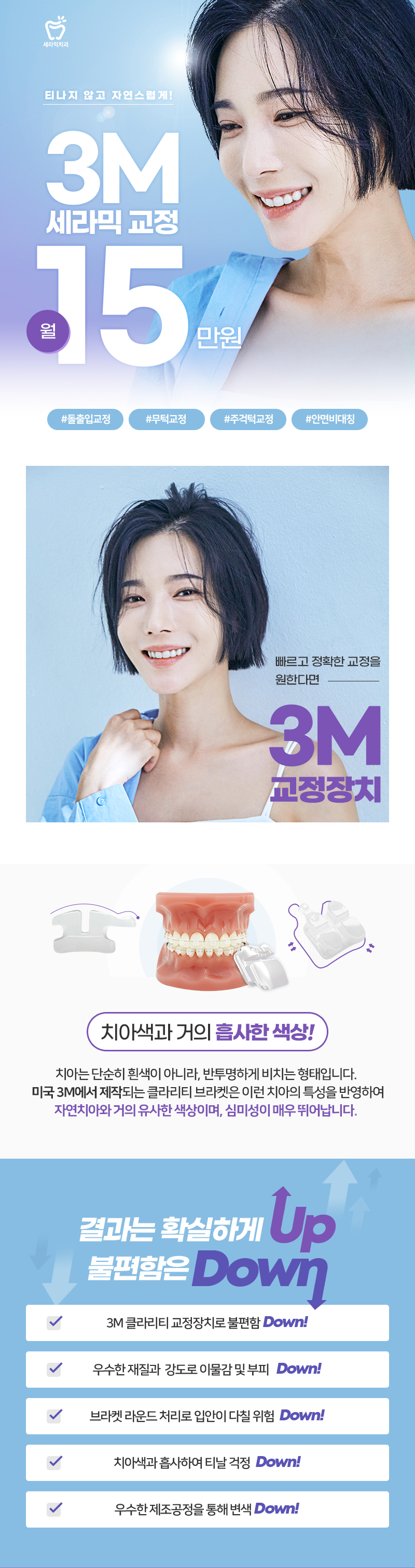 미국 3M사의 심미성이 뛰어난 세라믹 브라켓