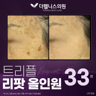 트리플 리팟 올인원