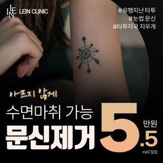 문신 제거 아프지 않게 수면마취가능