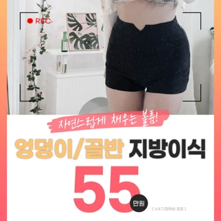 레디 엉덩이, 골반 지방이식