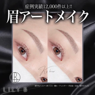 眉アートメイク1回・麻酔代込み【症例実績12,000件以上】