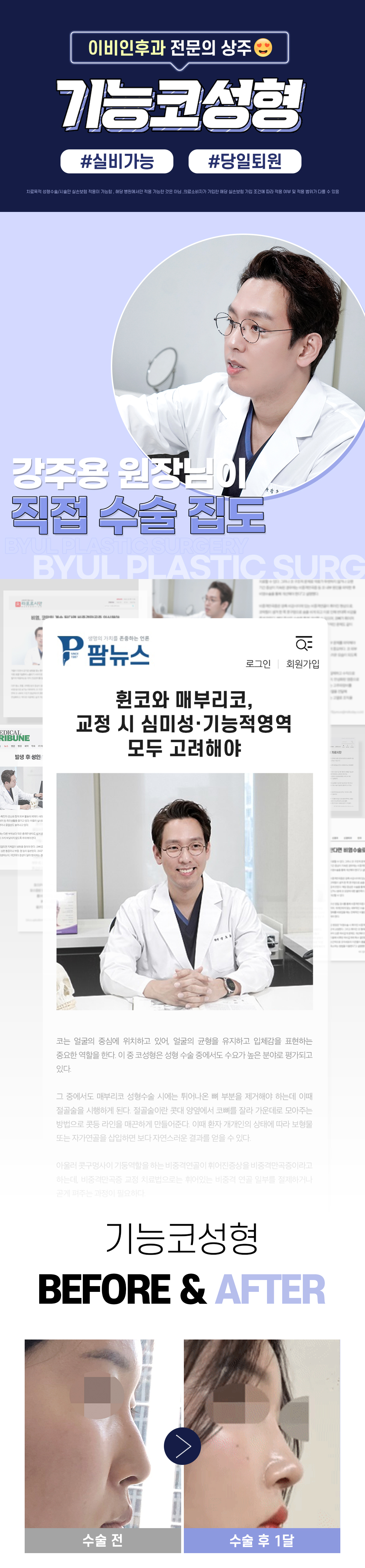 코성형 이벤트_기능코성형, 기능코수술, 코기능교정, 콧대교정, 코끝교정, 비염수술, 남자코, 콧대, 휜코, 매부리코, 코재수술