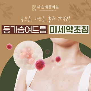 등여드름 가슴여드름 모공각화증 미세약초침