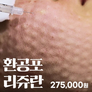 환공포 리쥬란힐러
