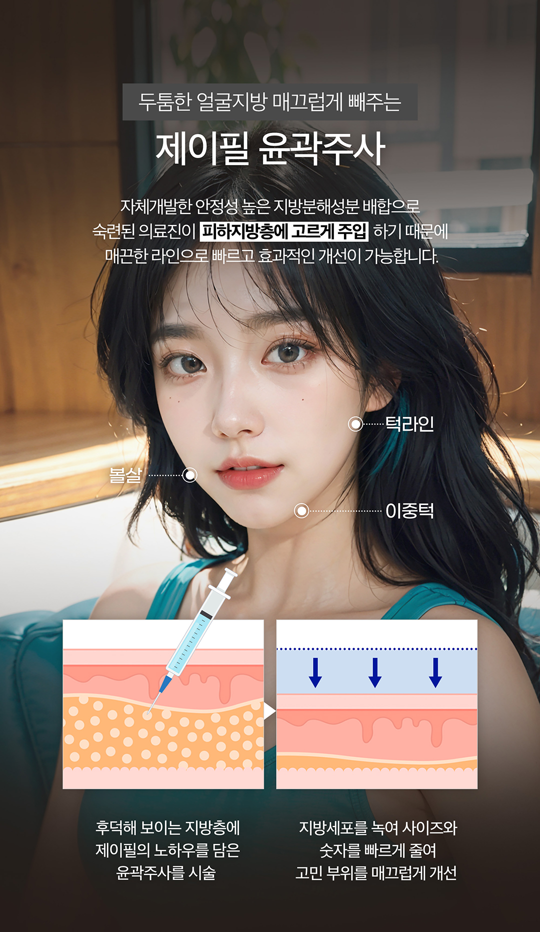 어느각도에서나 예쁘게 얼굴핏 살리는 제이필 파워윤곽톡스
지방분해하고 근육은 정리해서 날렵한 라인만 남기기
정품정량은 기본, 개인별 맞춤시술로 정확한 근육 축소의 턱보톡스와
고농축 지방분해 성분의 주사제를 사용하여 효과적으로 이중턱으로 개선하는 윤곽주사의 조합
- 사각턱축소, 얼굴붓기 감소, 이중턱 개선, 얼굴라인 개선