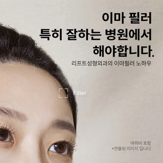 대구 리프트 이마필러, 이마보톡스