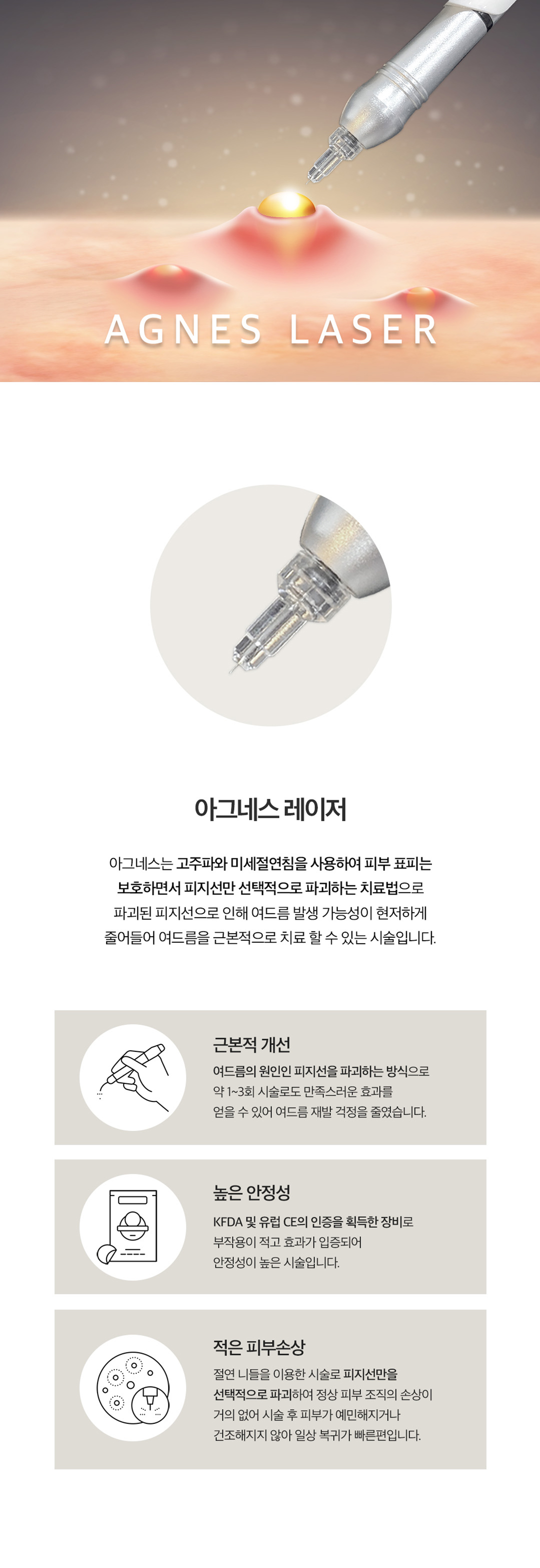 피지선 파괴 레이저 아그네스로 여드름 재발은 STOP
- 피부 표피는 보호하면서 피지선만 선택적으로 파괴하는 치료법
- 파괴된 피지선으로 인해 여드름 발생 가능성 DOWN
- 1~3회 시술로도 만족스러운 효과 얻을 수 있음
- KFDA 및 유럽 CE의 인증을 획득한 장비