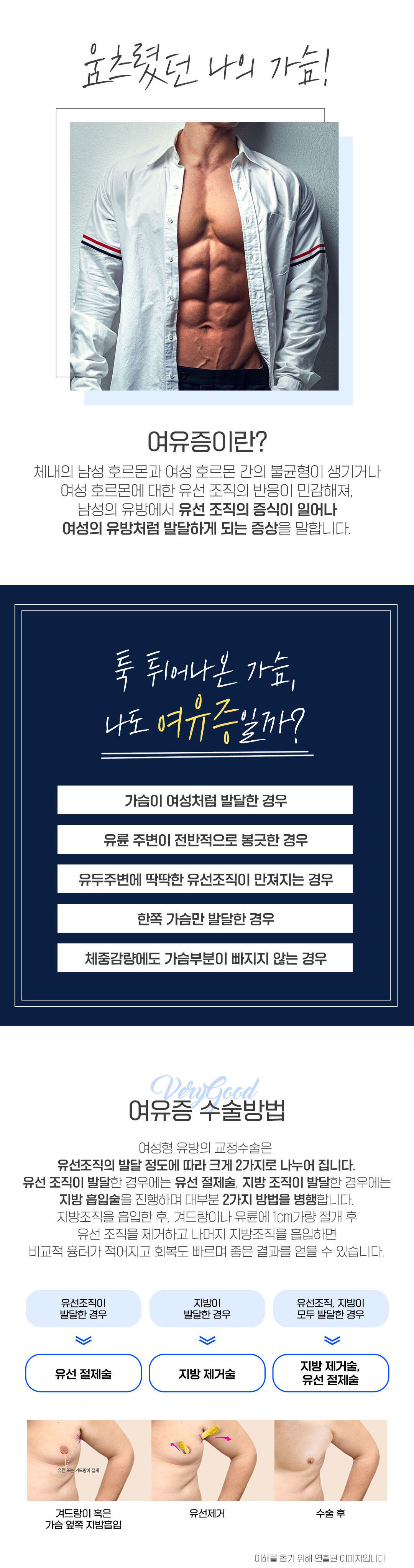 탄탄한가슴,드러내자 여유증 탈출도 베리굿 여유증수술

