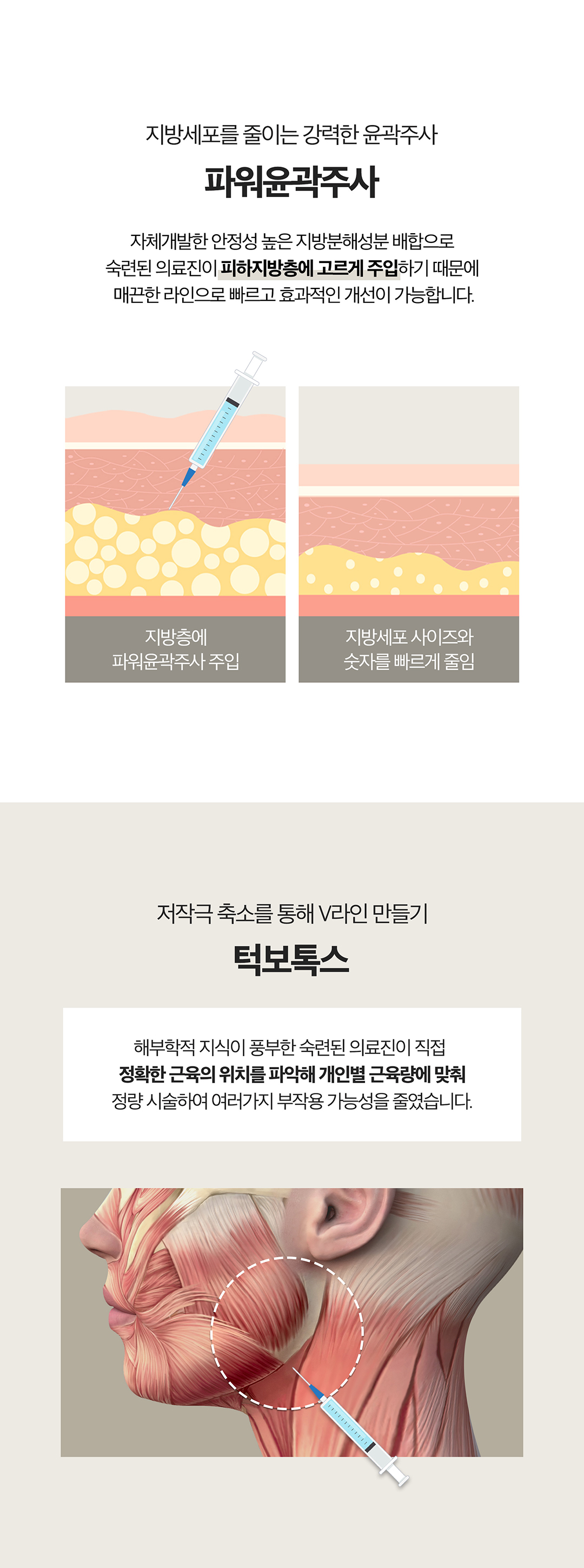 처진 얼굴형 고민을 이중턱or사각턱으로 나눠
얼굴살은 슈링크유니버스로 끌어올리고 고민유형에 맞는 솔루션 제공

- 슈링크 유니버스의 초음파 에너지로 근막부터 탄력개선
- 지방세포, 부종, 노폐물까지 배출하는 파워윤곽주사
- 정확한 근육위치에 주사해 발달한 근육을 줄여 갸름하게 만드는 근육보톡스
- 고민별 유형시술로 V라인 시너지 효과