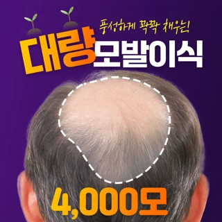 서진 꽉꽉채운 대량 모발이식 4000모