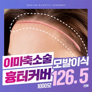 PRP 이마축소 흉터커버 모발이식