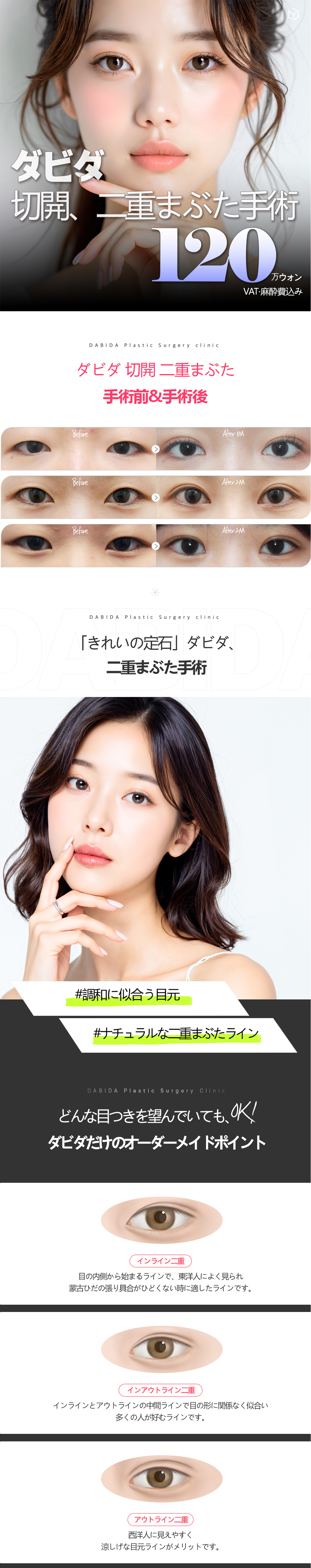 ダビダ切開二重手術 | ダビダ美容外科医院