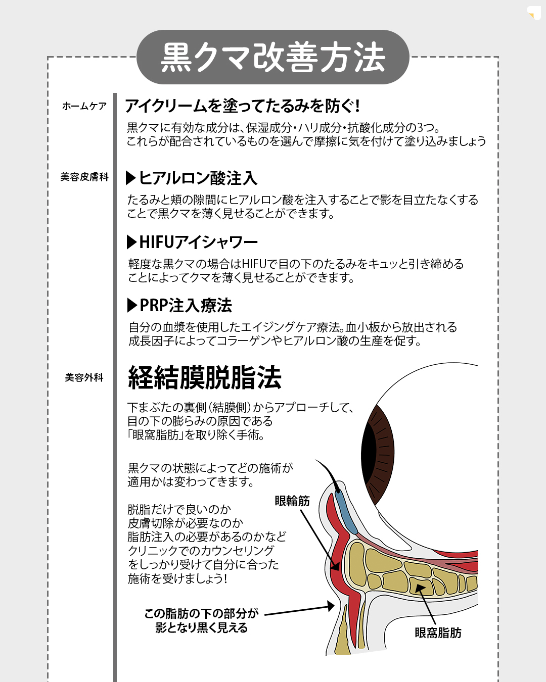 ※こちらのメニューは7月31日（木）までに施術を受けられた方限定の価格になります

▼eクリニックのクマ取り（脱脂法）について
脱脂法とは、目の下にできるふくらみを除去することで、クマや目の下のたるみを目立たせなくすることができる美容施術です。
脱脂法を行い、余分な眼窩脂肪を除去することで、目の周りをすっきりとさせ、若々しくハリのある目元を目指します。

▼脱脂法のメリット
・傷跡が残らない
・腫れや内出血が少ない
・ダウンタイムが短い
・効果が長持ちする


▼脂肪注入の併用について
脱脂のみでは目の下のボリュームが減少し、皮膚のたるみや窪みが強調されてしまう可能性がある場合は、併用での施術を行います。
脂肪注入をすることで、凹みや窪みを埋め、より自然な目元を目指します。

※医師が適応判断を行い、最適な治療をご提案させていただきますので、ご不安な方はカウンセリングの際に医師に直接お尋ねください。


【別途かかる費用】
・ダウンタイム軽減オプション代：¥55,000
・初診料：無料
・カウンセリング料：無料

【アフターケアについて】
ダウンタイムの過ごし方や注意事項などの詳細は、カウンセリング時にしっかりとお伝えさせていただきます。
当院は、術後のアフターケアに力を入れております。
ダウンタイム中に感じた不安点やトラブルなどは、すぐに対応いたします。
安心して受診・施術できるようスタッフが一丸となってサポートさせていただきますのでお気軽にご相談下さいませ。

【当日施術について】
当日の施術室の空き枠次第でご案内可能です。

【予約について】
ご予約のお申込みをしていだきましたら、クリニックからメールで確定のご連絡を差し上げます。

【未成年者のご来院について】
2022年4月より法改正に伴い18歳以上の方は、親権者の同伴が不要となります。18歳未満の方は、必ず親権者との同伴が必要になります。

【利用条件・モニターについて】
・SNSやHP等に全顔の掲載が可能な方
・施術前後に一定回数クリニックに通院し、ビフォー/アフターの撮影が可能な方


※非モニターの場合、通常価格でのご案内となります。
