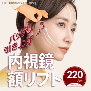 内視鏡額リフト(切開フェイスリフト)