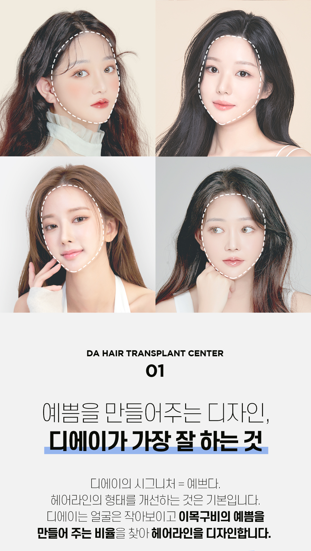 예쁜 얼굴형의 완성, 디에이 여성 헤어라인 모발이식 비절개 500모