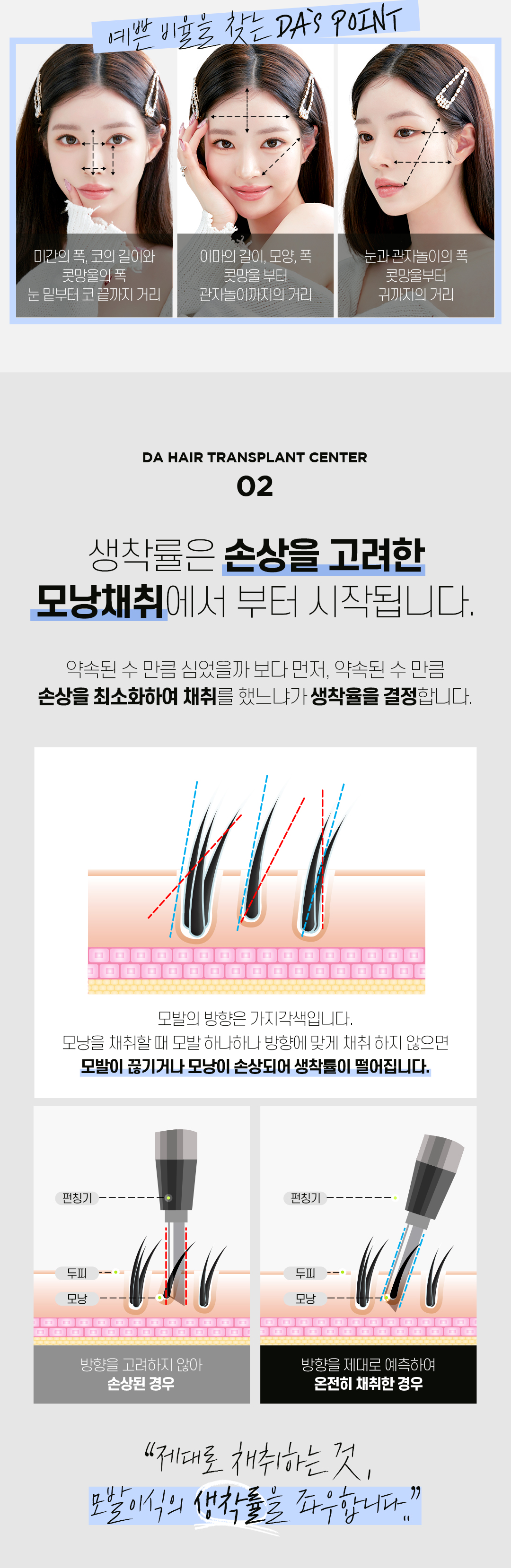 예쁜 얼굴형의 완성, 디에이 여성 헤어라인 모발이식 비절개 500모