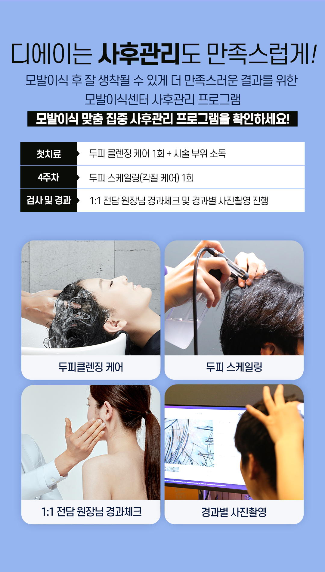 예쁜 얼굴형의 완성, 디에이 여성 헤어라인 모발이식 비절개 500모