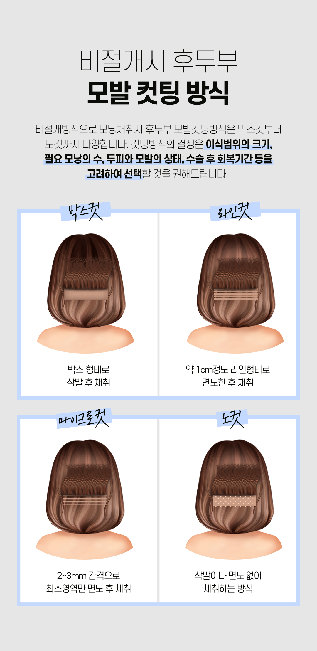 예쁜 얼굴형의 완성, 디에이 여성 헤어라인 모발이식 비절개 500모