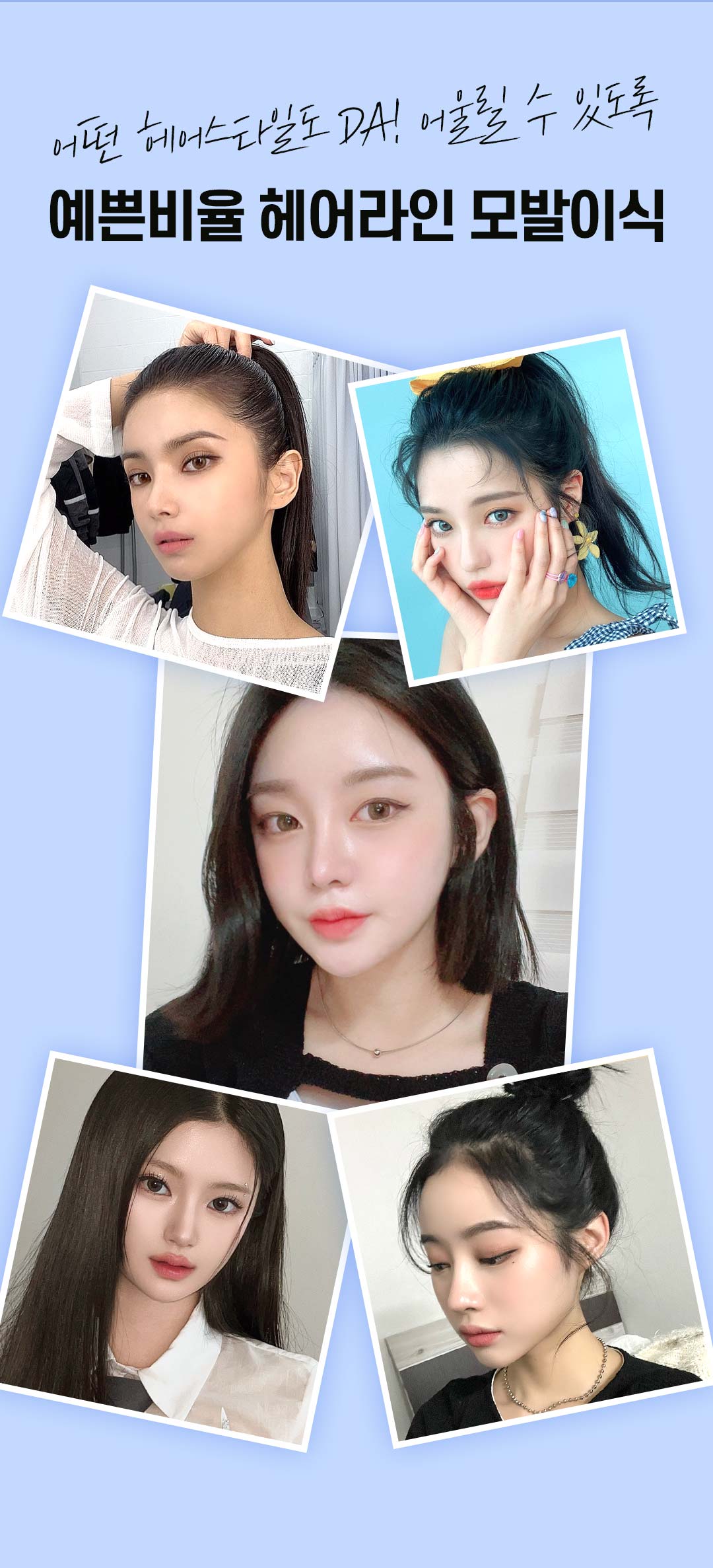 예쁜 얼굴형의 완성, 디에이 여성 헤어라인 모발이식 비절개 500모
