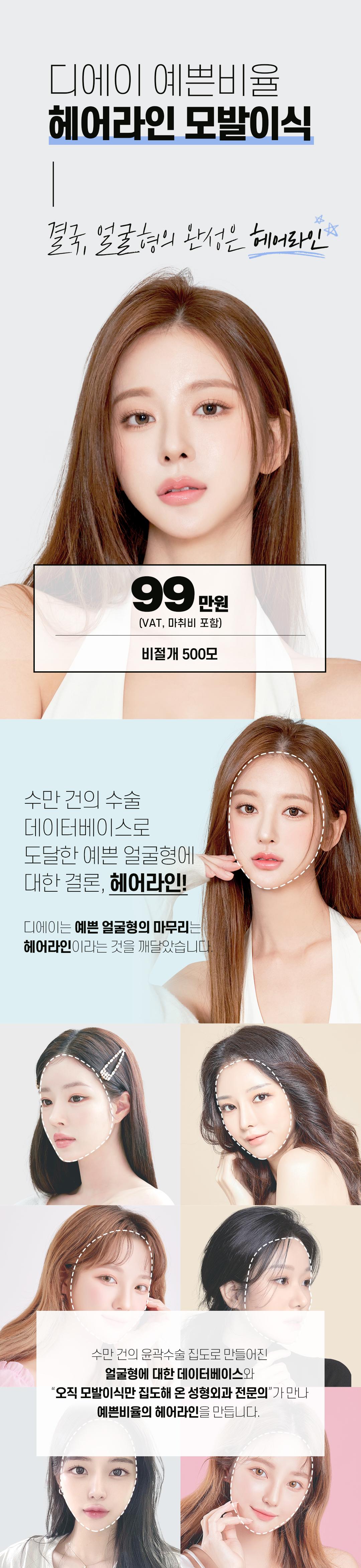 예쁜 얼굴형의 완성, 디에이 여성 헤어라인 모발이식 비절개 500모