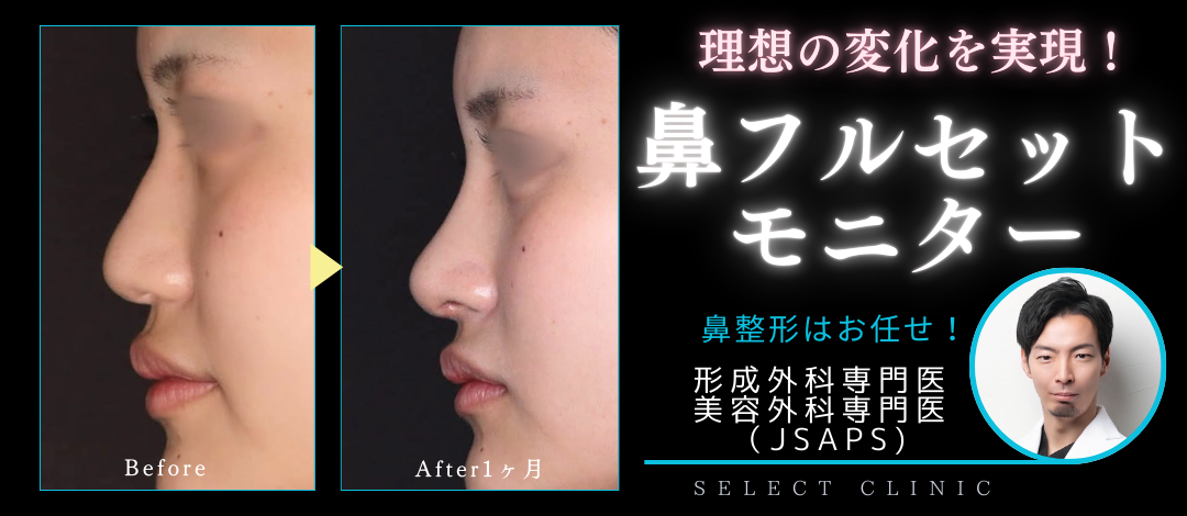 形成外科専門医】鼻フルセットモニター | SELECT CLINIC 大阪茶屋町院