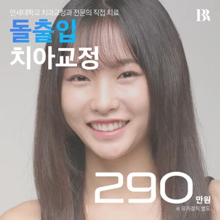 돌출입 교정 치아교정