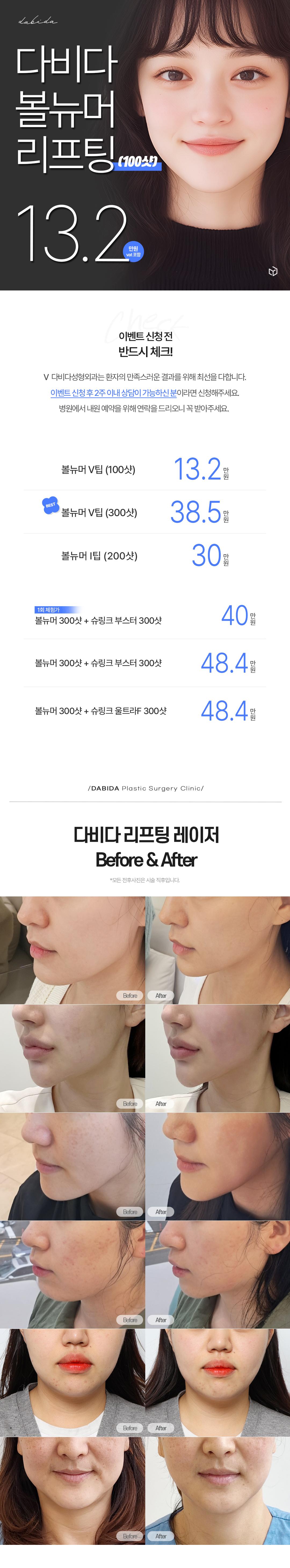 떨어진 얼굴 탄력 개선