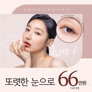 청담아이 눈성형