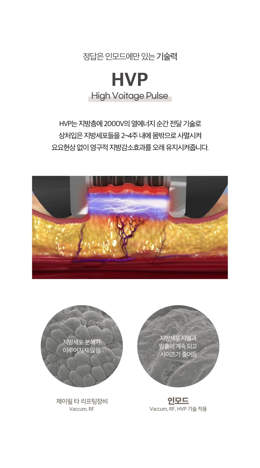 고주파 RF 에너지를 특허받은 기술을 통해
불필요한 지방을 파괴하고 지방이 빠진자리의 탄력을 끌어올려
V라인을 만드는 지방파괴 리프팅
-HVP 기술로 지방층까지 제대로된 에너지전달
-지방파괴&리프팅&콜라겐재생을 한번에