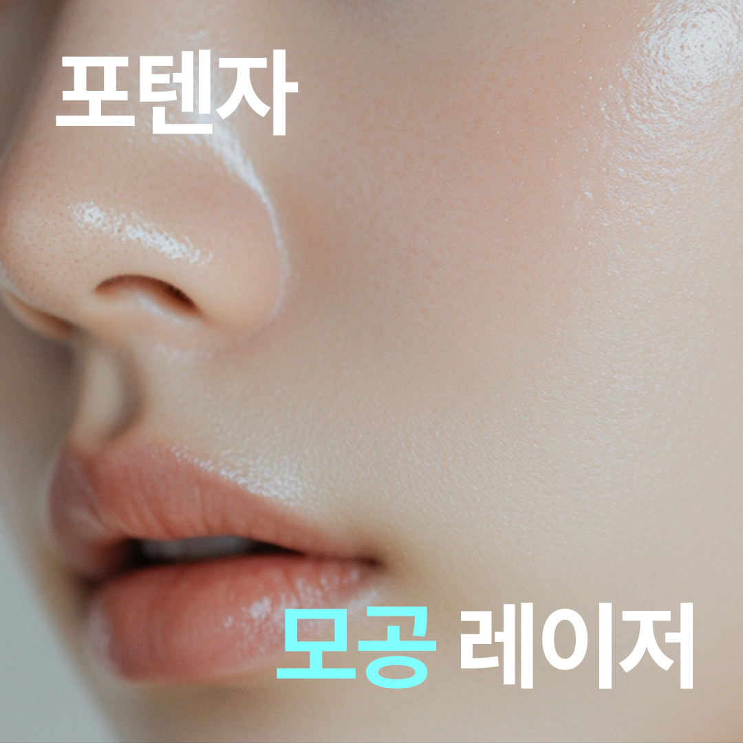포텐자 고주파 레이저 1회 - 피부관리, 모공축소, 여드름흉터&홍조 개선, 피부탄력강화, 잔주름제거