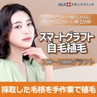 スマートグラフト自毛植毛
