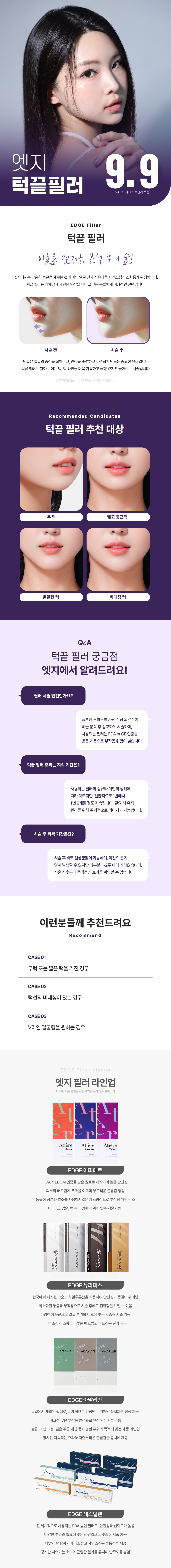 턱라인을 엣지있는 V라인으로 교정하다