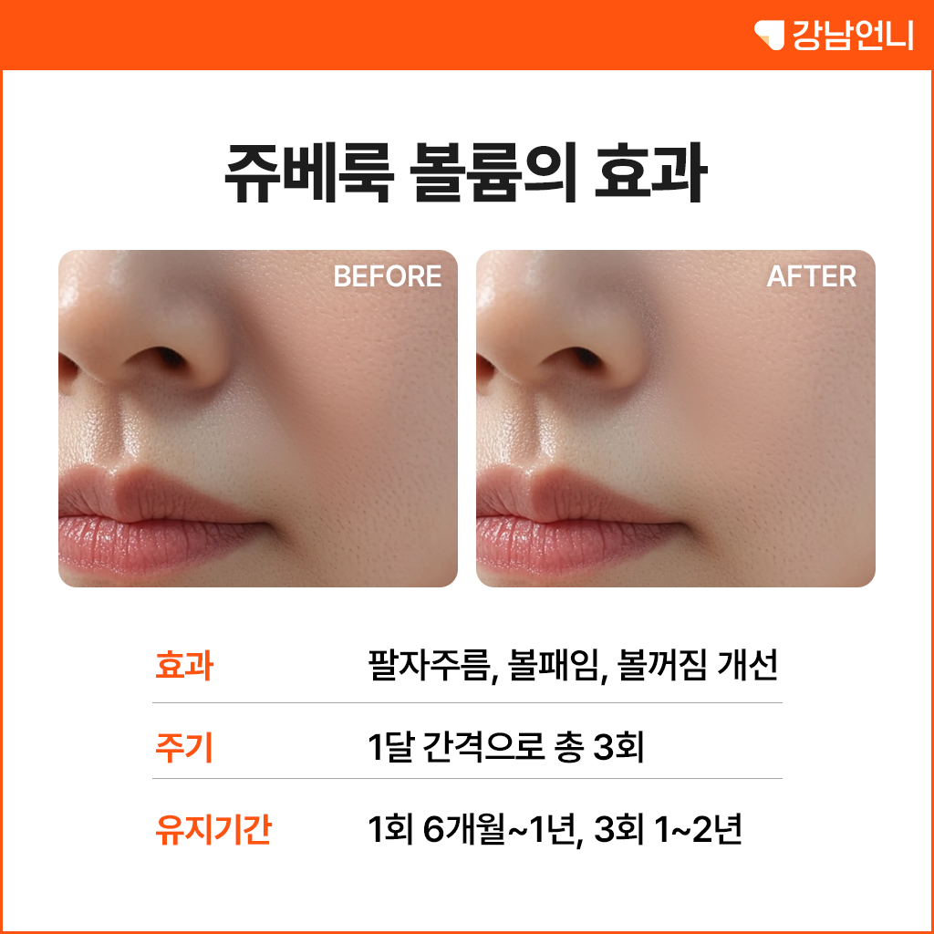 쥬베룩 볼륨, 팔자주름에 진짜 효과 있을까? 후기, 가격