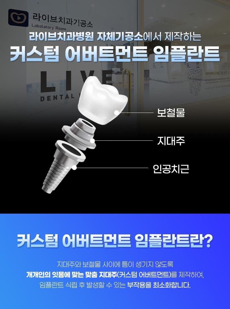 30세 이상 임플란트 시술을 원하는 강남언니 회원 대상!
지르코니아 크라운이 포함된 오스템 임플란트 39만원
- 10년 관리 프로그램 보유로 평생 사용할 임플란트 관리까지 철저하게!
- 실제 환자들의 만족후기로 믿을 수 있어요!
- 10년 넘게 자리를 지킨 폐업 우려 없는 '병원급' 치과!
- 하루만에 임플란트 가능한 원데이 임플란트!
- 자체 기공소 보유로 맞춤형 지대주 사용!