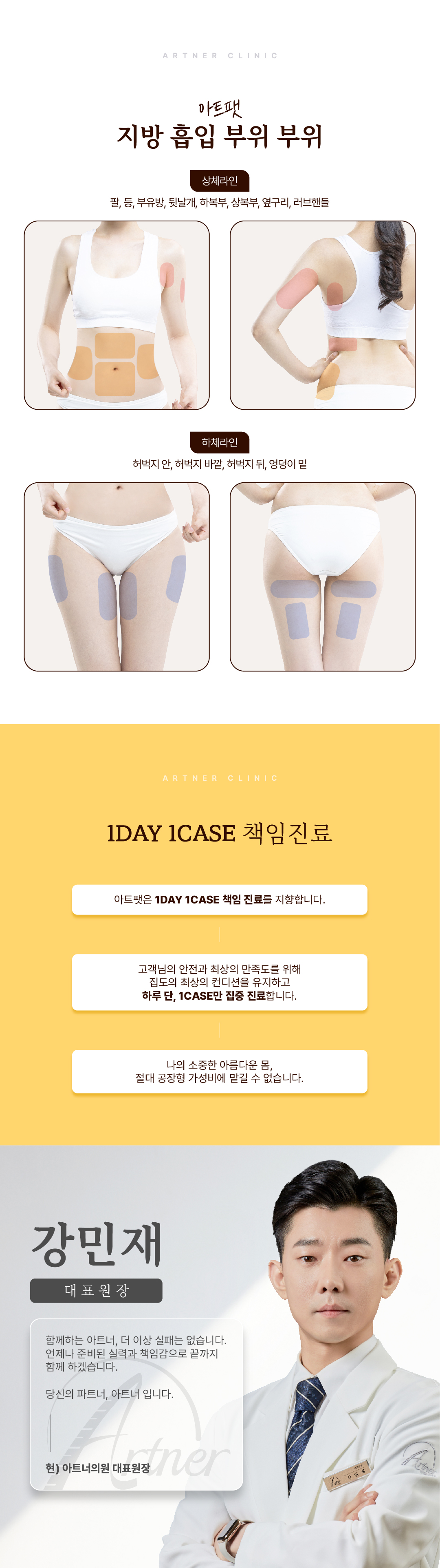 빠르고 확실한 정리, 눈으로 확인하는 미니지방흡입 아트팻