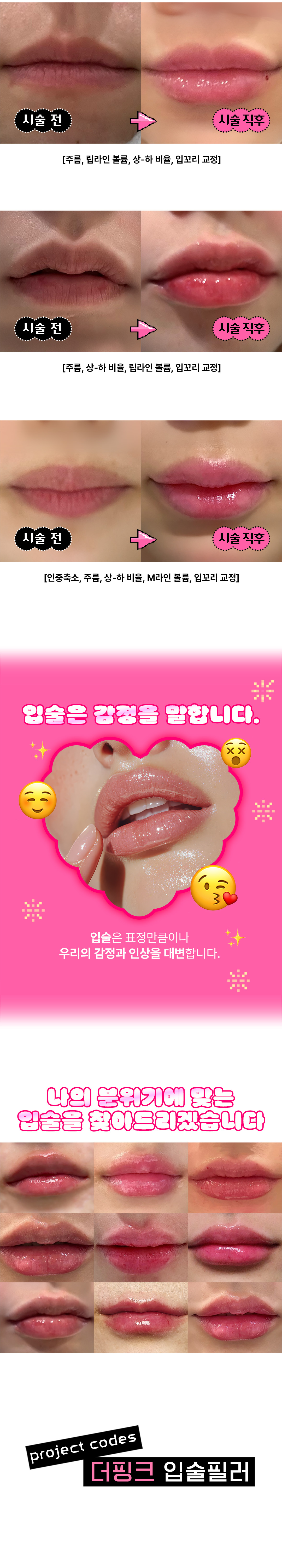 시술 전) 대표원장님과 1:1 맞춤 디자인 상담
시술 중) 고객님과 시술 중간마다 꼼꼼하게 디자인 체크
시술 후) 안심콜로 책임감 있는 고객케어
2025 전국 51인 Allergan AMI Global Fatculty '이경환' 대표원장님의 독자적 Project Codes 시술법으로, 나만의 분위기에 어울리는 입술을 찾아드리겠습니다.