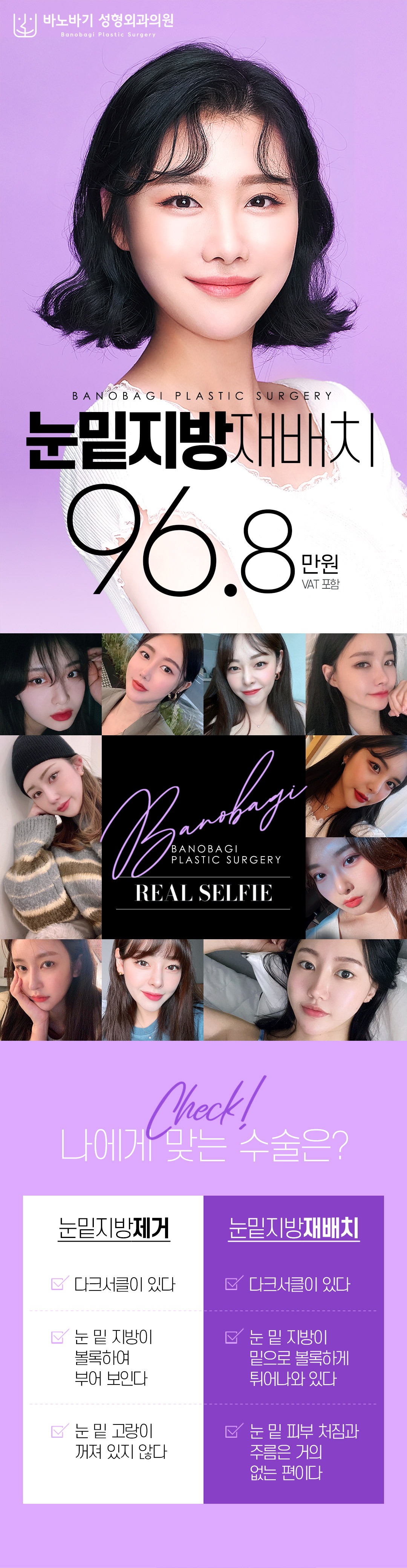 눈밑 고민을 개선하는 바노바기 눈밑지방재배치