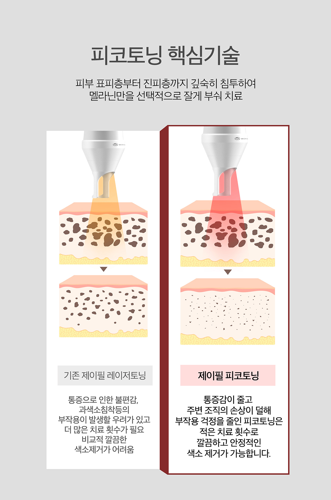 기미,잡티,주근깨,색소침착,여드름흉터 개선하고 촉촉함까지 더하기
정밀하고 주변 피부 조직의 손상을 줄이면서 피부 색소 병변을 치료하는 피코토닝
- 짧은 순간의 강력한 에너지로 색소를 빠르고 잘게 파괴
- 다양한 질환을 동시에 치료
- 기존 레이저 토닝에 비해 1000배 빠른 레이저 조사