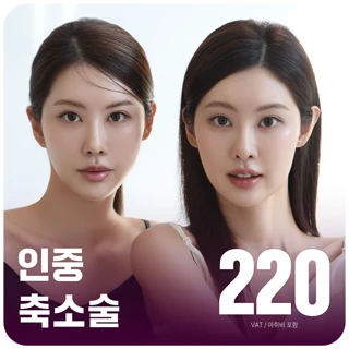 대구 엣지 인중 축소술