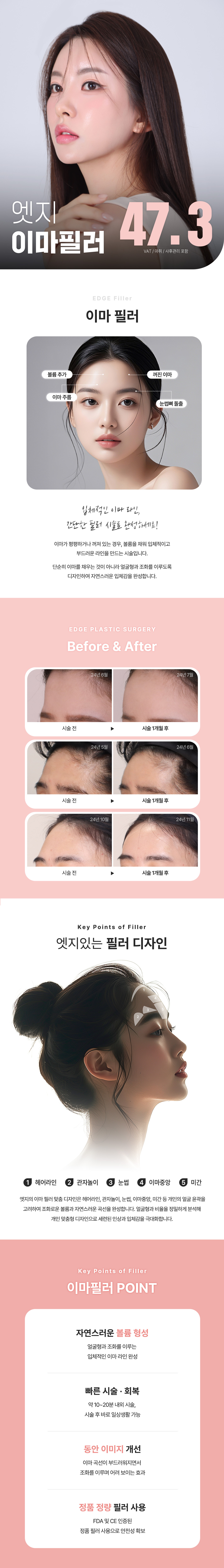 대구에서 티없이 이쁜 이마라인 만나봐요