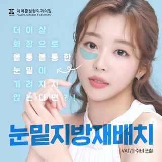 제이준 다크써클OUT 눈밑지방재배치
