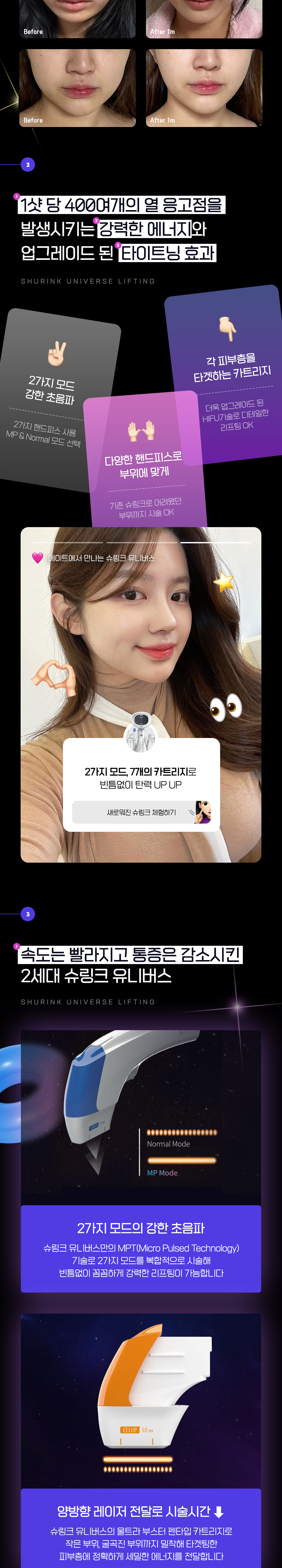 슈링크 유니버스 레이저리프팅X처진피부 끌어올려 만드는 V라인