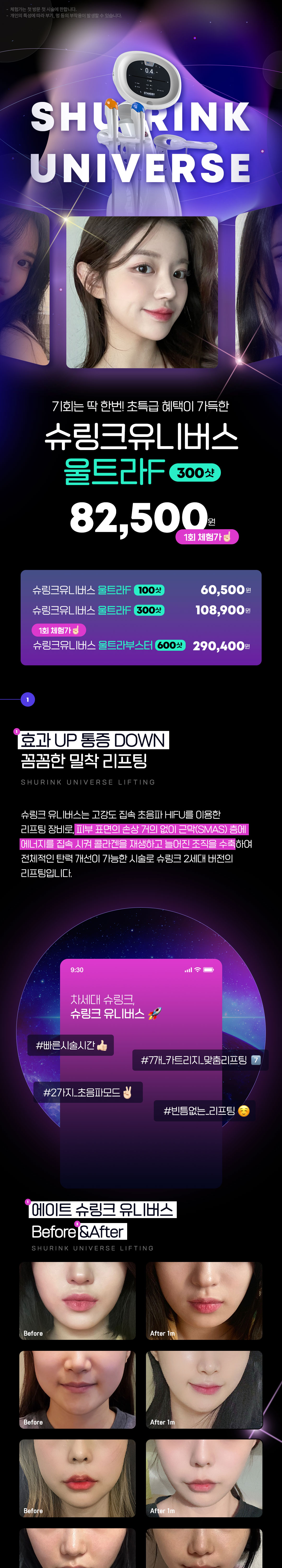 슈링크 유니버스 레이저리프팅X처진피부 끌어올려 만드는 V라인