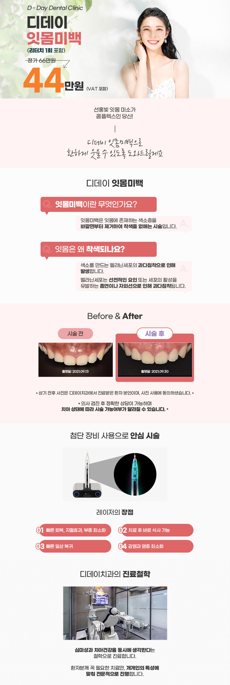 거뭇거뭇한 잇몸, 건강한 분홍빛으로 변신