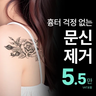 비앤미 타투문신제거