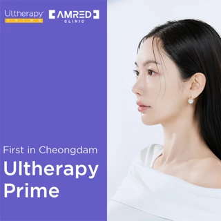 Ultherapy Prime Treatment