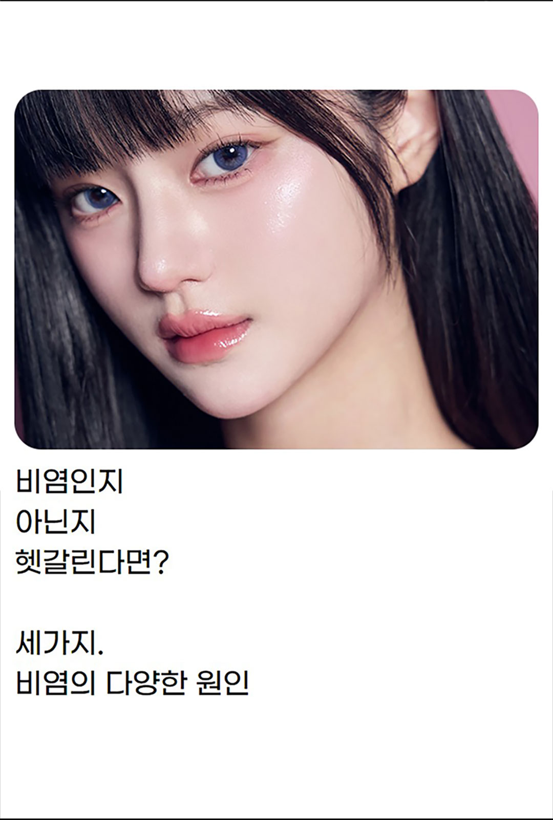 코끝부터 콧대까지 개선하는 비염코성형